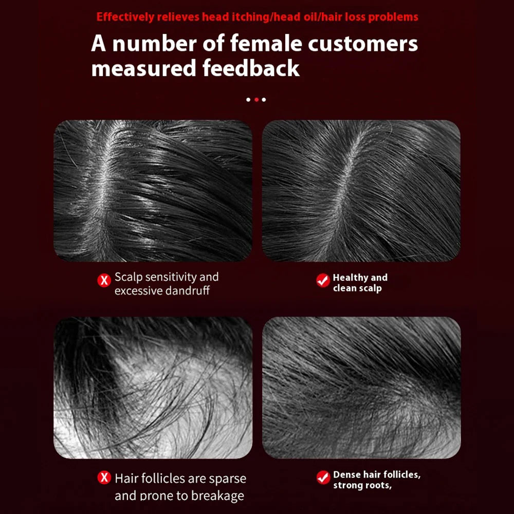 HairFlow Red Light Scalp Massager