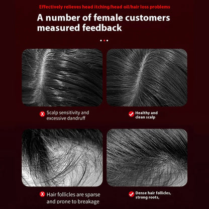 HairFlow Red Light Scalp Massager